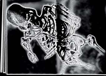 Skelly